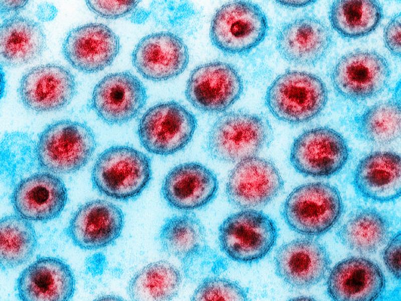 A computer-enhanced image of the HIV virus. A computer-enhanced image of the HIV virus.