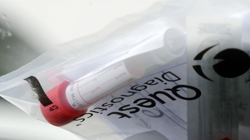 A testing kit sits on the windshield of a car as it passes through a drive-through COVID-19 testing site set up in St. Charles, Mo. A testing kit sits on the windshield of a car as it passes through a drive-through COVID-19 testing site set up in St. Charles, Mo.