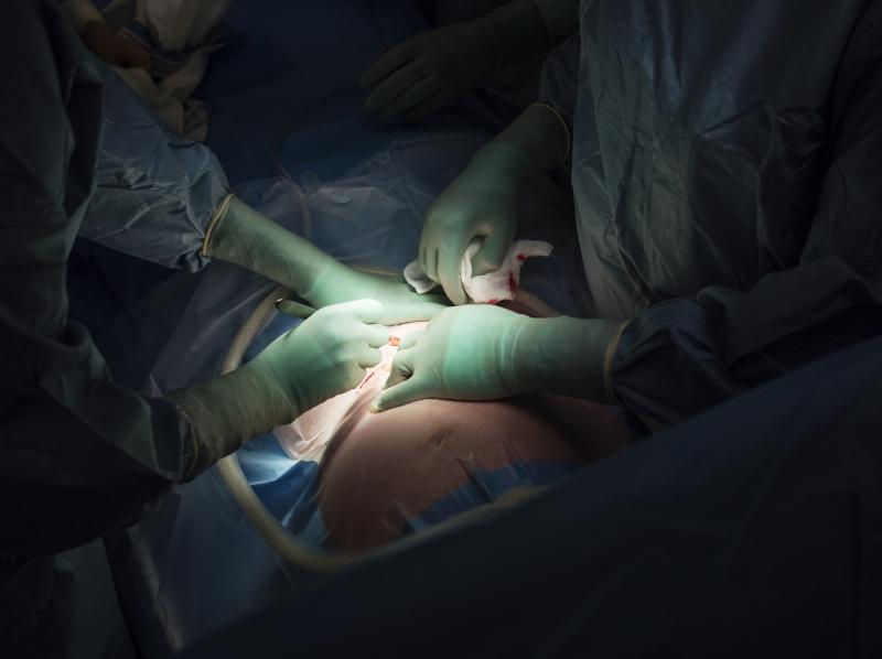 Surgeons perform a cesarean section. A new report raises concerns about rising rates of this procedure around the world, from Brazil to China. Surgeons perform a cesarean section. A new report raises concerns about rising rates of this procedure around the world, from Brazil to China.