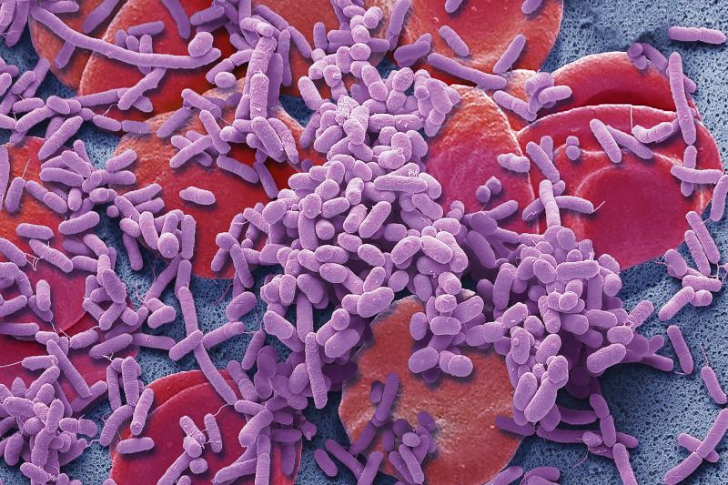 Bacteria (purple) in the bloodstream can trigger sepsis, a life-threatening illness. Bacteria (purple) in the bloodstream can trigger sepsis, a life-threatening illness.