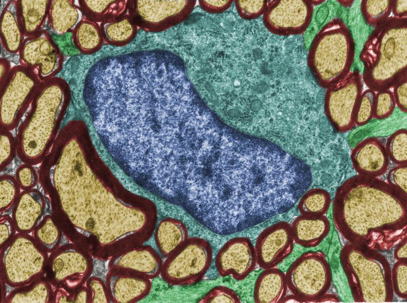 This image from an electron microscope shows a cross-sectional view of an oligodendrocyte (blue) among nerve fibers coated with myelin (dark red). In models of autism spectrum disorder, oligodendrocytes appear to create too much or too little myelin. This image from an electron microscope shows a cross-sectional view of an oligodendrocyte (blue) among nerve fibers coated with myelin (dark red). In models of autism spectrum disorder, oligodendrocytes appear to create too much or too little myelin.