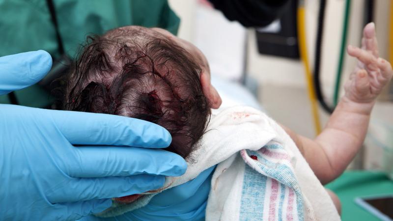 When a baby is born by cesarean section, she misses out on Mom's microbes in the birth canal. When a baby is born by cesarean section, she misses out on Mom's microbes in the birth canal.