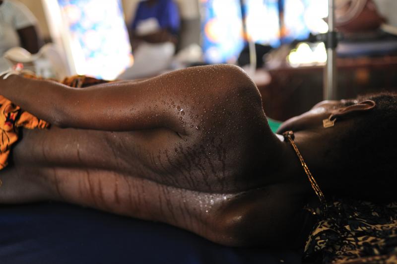 A woman in labor in the maternity ward at the Princess Christian Maternity Hospital in Freetown, Sierra Leone. With lockdowns have come fears of even greater numbers of home births. A woman in labor in the maternity ward at the Princess Christian Maternity Hospital in Freetown, Sierra Leone. With lockdowns have come fears of even greater numbers of home births.