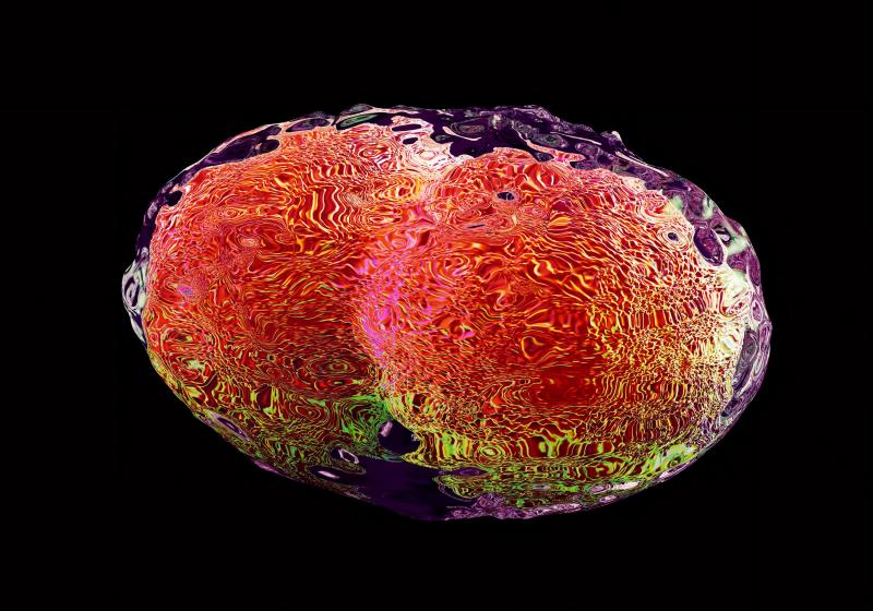 A computer illustration of the virus that causes smallpox. The virus was eradicated in 1980, but live samples are kept in two known labs for research. A computer illustration of the virus that causes smallpox. The virus was eradicated in 1980, but live samples are kept in two known labs for research.
