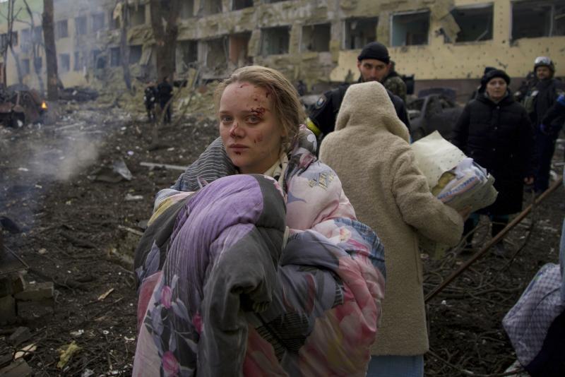 Mariana Vishegirskaya stands outside a maternity hospital that was damaged by shelling in Mariupol, Ukraine, on March 9. Vishegirskaya later gave birth to a girl in another hospital in Mariupol. Mariana Vishegirskaya stands outside a maternity hospital that was damaged by shelling in Mariupol, Ukraine, on March 9. Vishegirskaya later gave birth to a girl in another hospital in Mariupol.