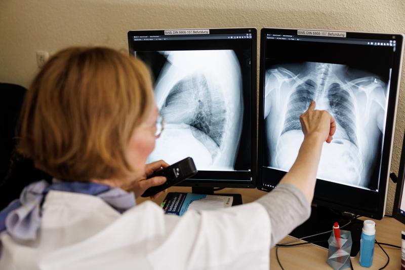 Refugees from Ukraine, which has a high rate of tuberculosis, are often screened for the disease. Above: Dr. Natalie Wöhrle analyzes the X-ray images of the lungs from a screening in Gauting, Germany, on March 12. Refugees from Ukraine, which has a high rate of tuberculosis, are often screened for the disease. Above: Dr. Natalie Wöhrle analyzes the X-ray images of the lungs from a screening in Gauting, Germany, on March 12.