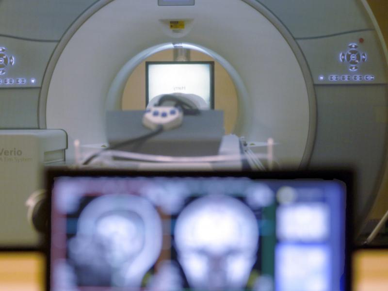 Scientists have analyzed a huge number of brain scans to learn more about how the brain develops, from infancy all the way until the end of life. Scientists have analyzed a huge number of brain scans to learn more about how the brain develops, from infancy all the way until the end of life.