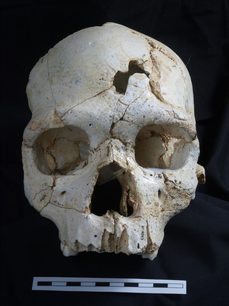 A team of scientists say they've discovered evidence of a 435,000 year old murder, based on evidence from the injuries on this skull. A team of scientists say they've discovered evidence of a 435,000 year old murder, based on evidence from the injuries on this skull.
