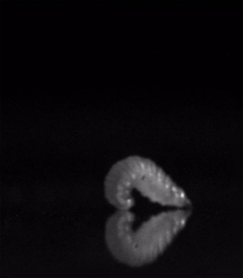 A goldenrod midge maggot begins to form a loop. A goldenrod midge maggot begins to form a loop.