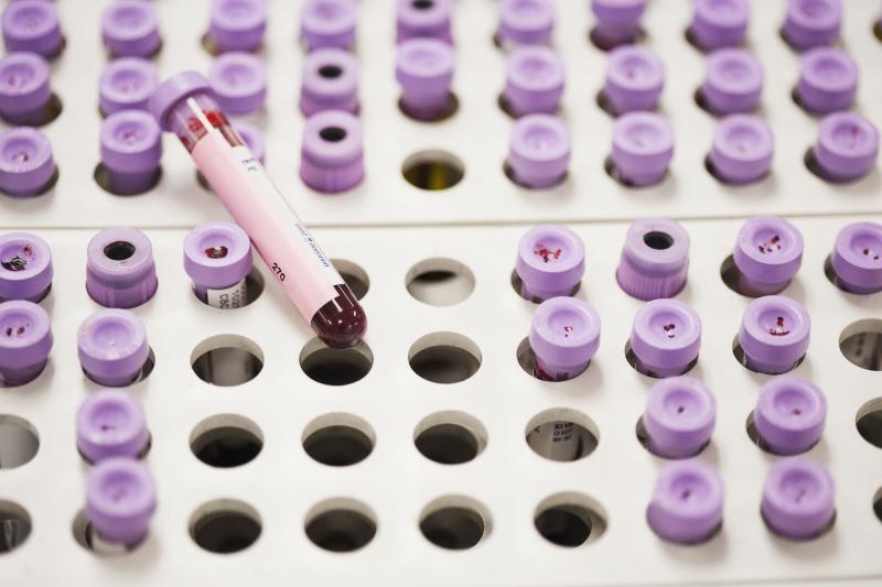 Researchers have identified waves of proteins in blood that peak at three distinct stages of life. What do the findings mean for aging? Researchers have identified waves of proteins in blood that peak at three distinct stages of life. What do the findings mean for aging?