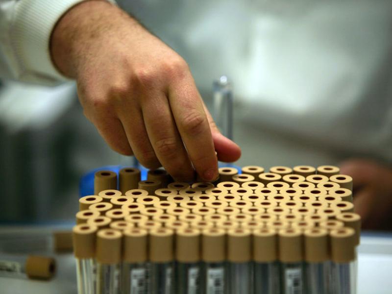 Researchers looked for genetic variants linked to sexual behavior in new genetic research that analyzed DNA from donated blood samples from nearly half a million middle-aged people from Britain who participated in a project called UK Biobank. Researchers looked for genetic variants linked to sexual behavior in new genetic research that analyzed DNA from donated blood samples from nearly half a million middle-aged people from Britain who participated in a project called UK Biobank.