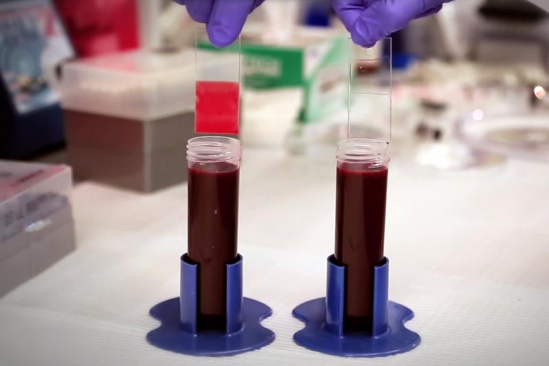 The slide on the right has been treated with a coating that repels blood. The slide on the right has been treated with a coating that repels blood.