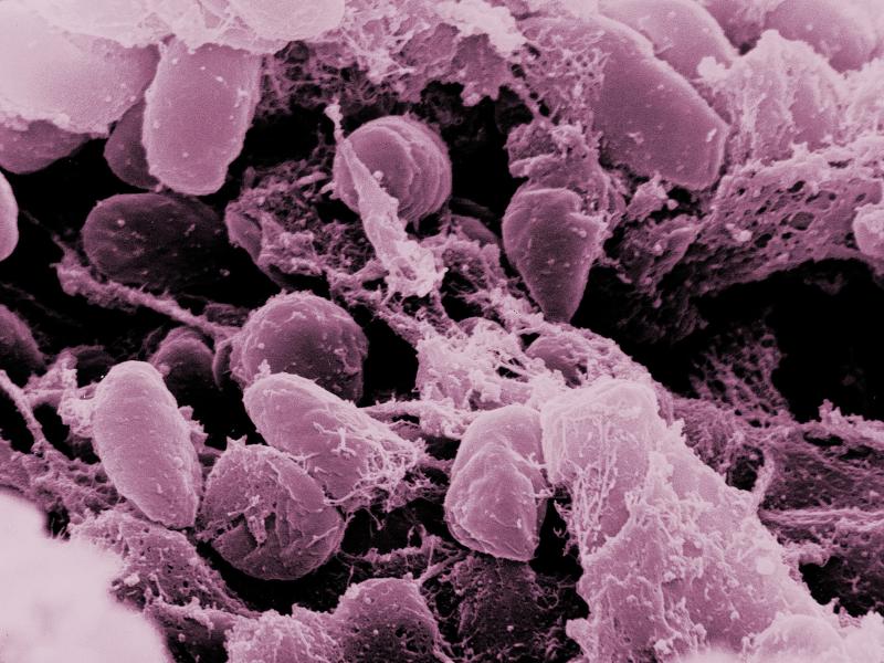 Rod-shaped specimens of Yersinia pestis, the bacterial cause of plague, find a happy home here in the foregut of a flea. Fleas can transmit the infection to animals and people, who can get pneumonic plague and transmit the infection through a cough or kis Rod-shaped specimens of Yersinia pestis, the bacterial cause of plague, find a happy home here in the foregut of a flea. Fleas can transmit the infection to animals and people, who can get pneumonic plague and transmit the infection through a cough or kis