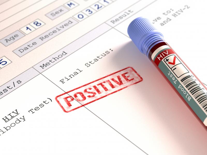 Positive HIV (human immunodeficiency virus) blood test results, computer illustration. Positive HIV (human immunodeficiency virus) blood test results, computer illustration.