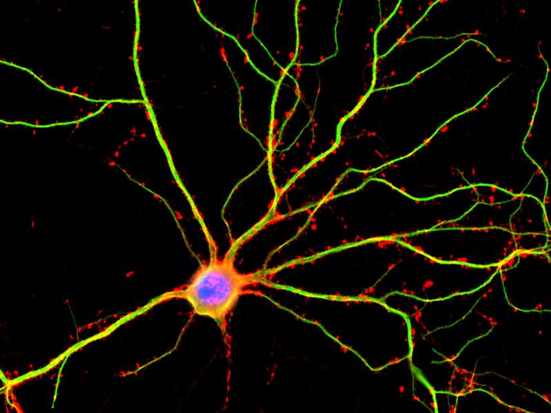 A hippocampal neuron seen in culture. Dendrites are green, dendritic spines are red and DNA is blue. A hippocampal neuron seen in culture. Dendrites are green, dendritic spines are red and DNA is blue.