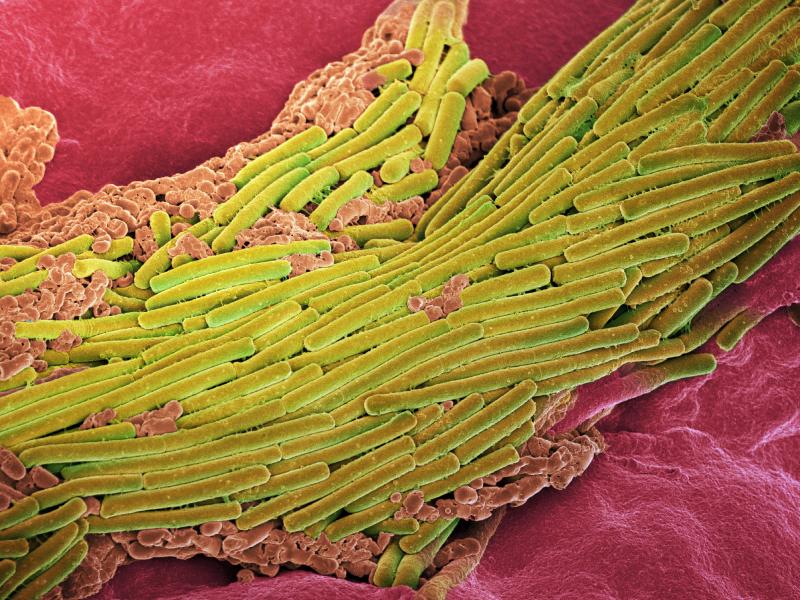 C. difficile bacteria, shown in yellow, are common in hospitals and nursing homes, and very difficult to treat. C. difficile bacteria, shown in yellow, are common in hospitals and nursing homes, and very difficult to treat.