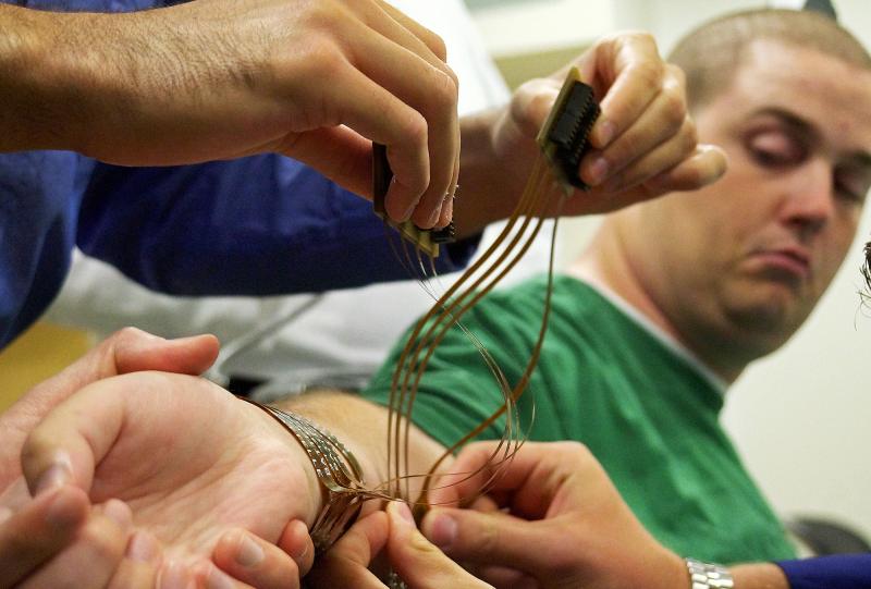 Ian Burkhart prepares for a training session in Columbus, Ohio. To move muscles in Burkhart's hand, the system relies on electrodes implanted in his brain, a computer interface attached to his skull, and electrical stimulators wrapped around his forearm. Ian Burkhart prepares for a training session in Columbus, Ohio. To move muscles in Burkhart's hand, the system relies on electrodes implanted in his brain, a computer interface attached to his skull, and electrical stimulators wrapped around his forearm.
