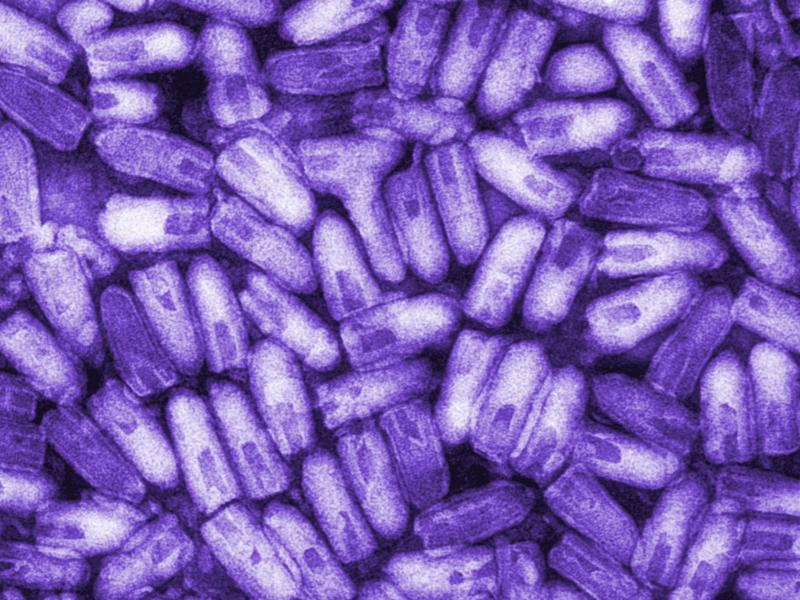 The infectious and contagious rabies virus, shown here in a colorized micrograph, can be transmitted to humans through the bite or saliva of an infected animal. Thanks to protective vaccination of pets, rabies was eliminated from the U.S. dog population i The infectious and contagious rabies virus, shown here in a colorized micrograph, can be transmitted to humans through the bite or saliva of an infected animal. Thanks to protective vaccination of pets, rabies was eliminated from the U.S. dog population i