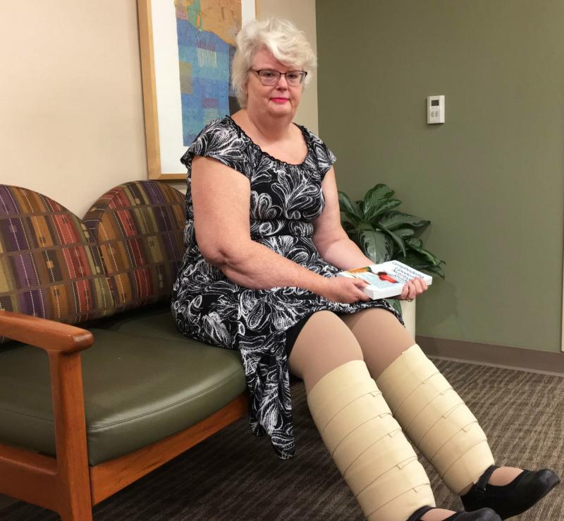Marlene Simpson of Sacramento, Calif., wears compression bandages daily to help reduce the swelling in her legs. She is getting fitted for compression bandages for her arms to prevent swelling there. Marlene Simpson of Sacramento, Calif., wears compression bandages daily to help reduce the swelling in her legs. She is getting fitted for compression bandages for her arms to prevent swelling there.
