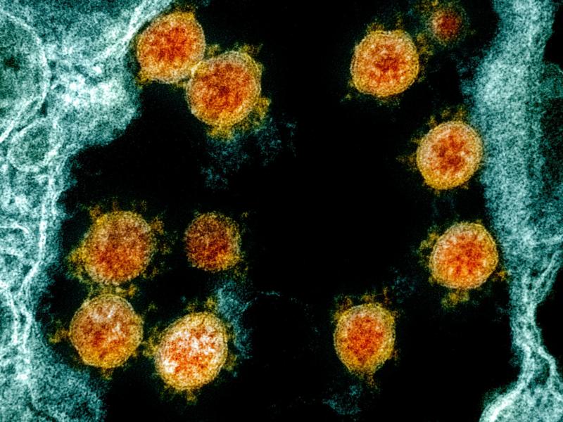 Internationally, scientists now have on file the genomes of more than 47,000 different samples of the virus that causes COVID-19 — up from just one in January. Here's a transmission electron micrograph of SARS-CoV-2 virus particles (orange) isolated fro Internationally, scientists now have on file the genomes of more than 47,000 different samples of the virus that causes COVID-19 — up from just one in January. Here's a transmission electron micrograph of SARS-CoV-2 virus particles (orange) isolated fro