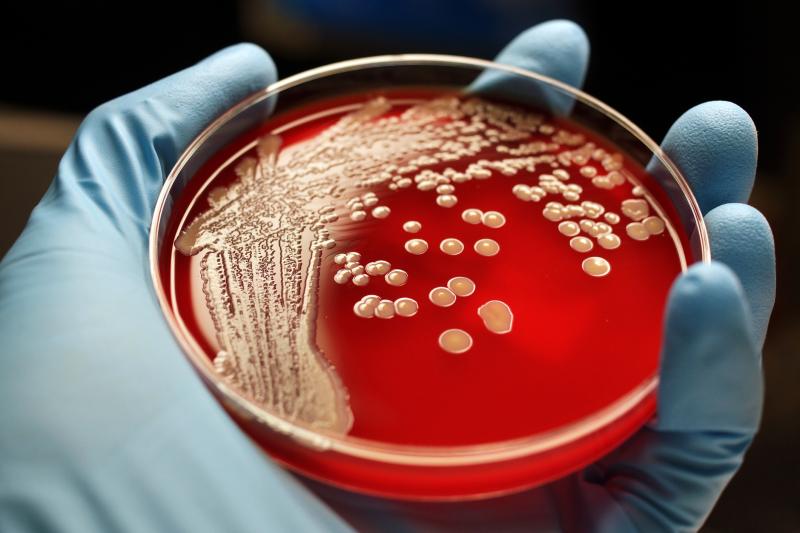 Scientists are exploring new drugs that can fight antibiotic-resistant bacteria such as MRSA. Scientists are exploring new drugs that can fight antibiotic-resistant bacteria such as MRSA.
