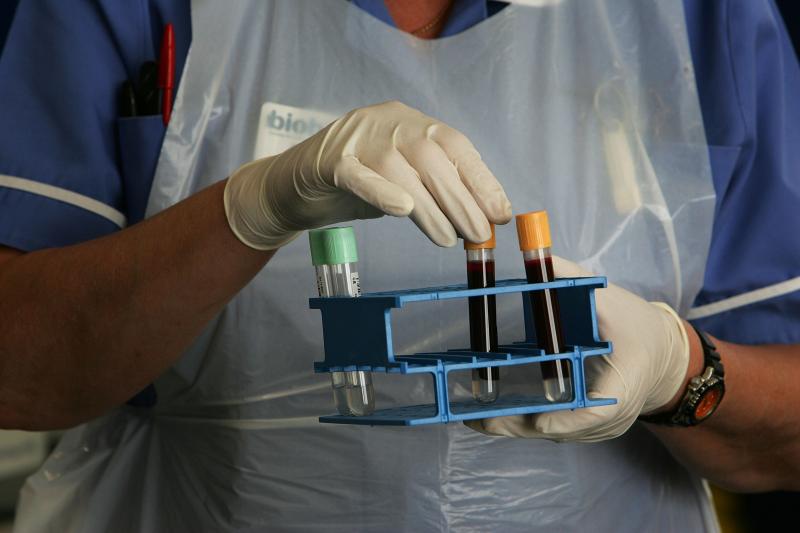UK Biobank, based in Manchester, England, is the largest blood-based research project in the world. The research project will involve at least 500,000 people across the U.K., and follow their health for next 30 years or more, providing a resource for scie UK Biobank, based in Manchester, England, is the largest blood-based research project in the world. The research project will involve at least 500,000 people across the U.K., and follow their health for next 30 years or more, providing a resource for scie