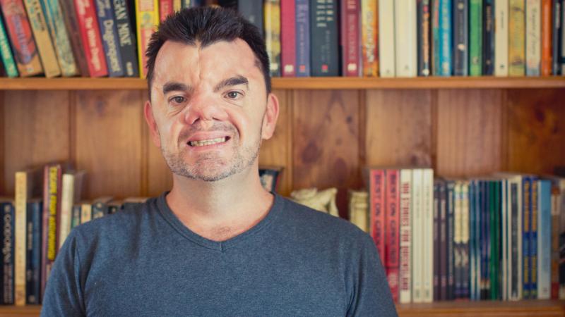 A writer by profession, Robert Hoge was the first member of his family to go to college. A writer by profession, Robert Hoge was the first member of his family to go to college.
