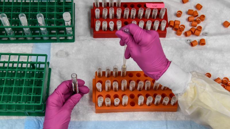 A lab technician sorts blood samples for a COVID-19 vaccination study at the Research Centers of America in Hollywood, Fla., on Aug. 13. A lab technician sorts blood samples for a COVID-19 vaccination study at the Research Centers of America in Hollywood, Fla., on Aug. 13.
