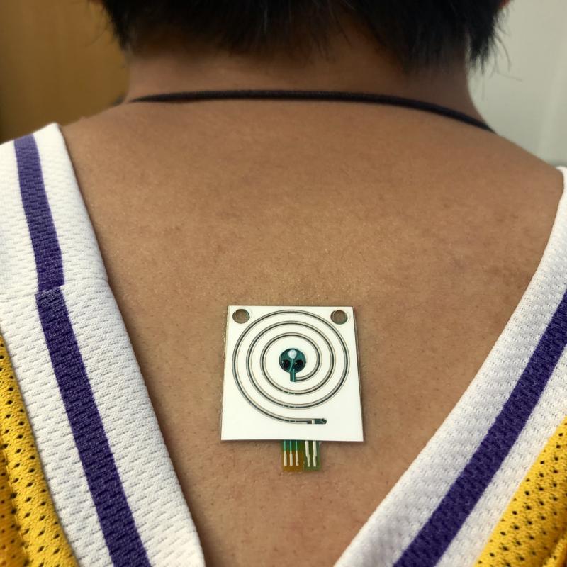 A sensor developed by scientists at U.C. Berkeley can provide real-time measurements of sweat rate and electrolytes in sweat. A sensor developed by scientists at U.C. Berkeley can provide real-time measurements of sweat rate and electrolytes in sweat.