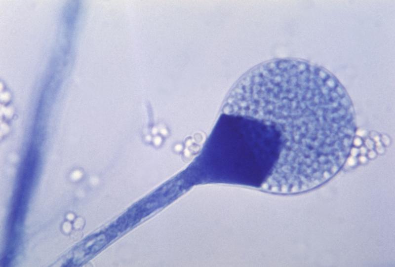 A light micrograph of a mature sporangium of a mucor fungus. India is seeing a rise in cases of mucormycosis, a rare but dangerous fungal infection. A light micrograph of a mature sporangium of a mucor fungus. India is seeing a rise in cases of mucormycosis, a rare but dangerous fungal infection.