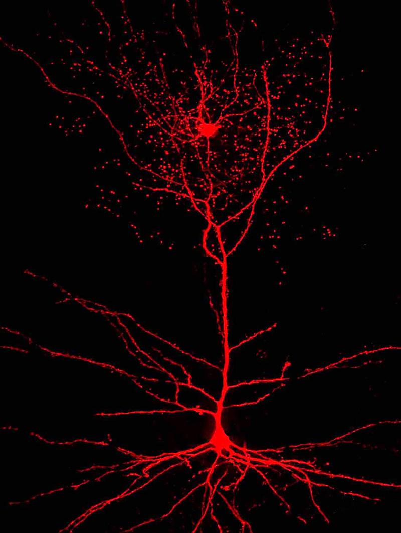 An image of a rosehip neuron (top) and a connecting pyramidal cell (bottom). An image of a rosehip neuron (top) and a connecting pyramidal cell (bottom).