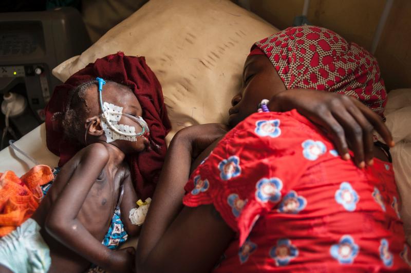 A woman and a child suffering from severe malnutrition sleep on a bed at a therapeutic feeding center in northeastern Nigeria. A woman and a child suffering from severe malnutrition sleep on a bed at a therapeutic feeding center in northeastern Nigeria.