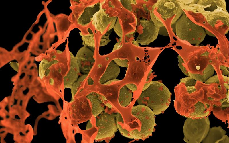 MRSA (methicillin-resistant Staphylococcus aureus), depicted above in yellow and surrounded by cellular debris, is a staph bacterium that resists treatment by many common antibiotics. The image is from a scanning electron micrograph. MRSA (methicillin-resistant Staphylococcus aureus), depicted above in yellow and surrounded by cellular debris, is a staph bacterium that resists treatment by many common antibiotics. The image is from a scanning electron micrograph.