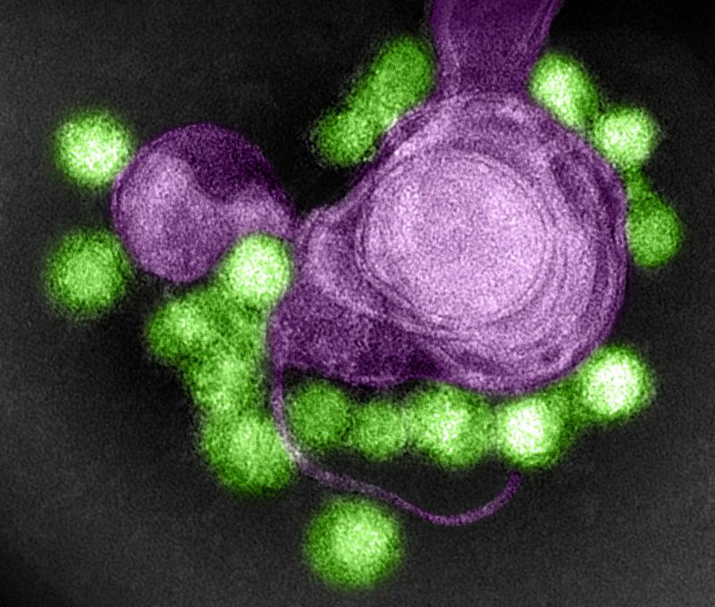 A strain of the Zika virus is stained green in this image from a transmission electron microscope. The virus sample came from a microcephaly case in Brazil. A strain of the Zika virus is stained green in this image from a transmission electron microscope. The virus sample came from a microcephaly case in Brazil.