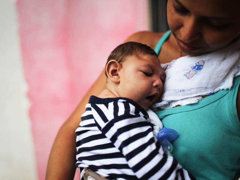 A mother holds her baby, who has microcephaly, in Recife, Brazil. A mother holds her baby, who has microcephaly, in Recife, Brazil.