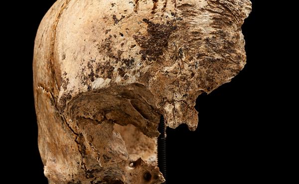 The four cuts at the top of this skull "are clear chops to the forehead," says Smithsonian forensic anthropologist Douglas Owsley. Based on forensic evidence, researchers think the blows were made after the person died. The four cuts at the top of this skull "are clear chops to the forehead," says Smithsonian forensic anthropologist Douglas Owsley. Based on forensic evidence, researchers think the blows were made after the person died.