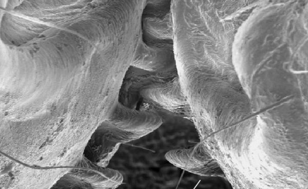 An image from an electron microscope of the back legs of a planthopper insect. An image from an electron microscope of the back legs of a planthopper insect.