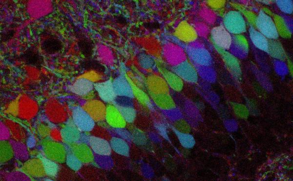 More than 100 years ago, Golgi staining on nerve cells opened the gates to modern neuroscience. Scientists recently developed the Technicolor version of Golgi staining, Brainbow, allowing more detailed reconstructions of brain circuits. More than 100 years ago, Golgi staining on nerve cells opened the gates to modern neuroscience. Scientists recently developed the Technicolor version of Golgi staining, Brainbow, allowing more detailed reconstructions of brain circuits.