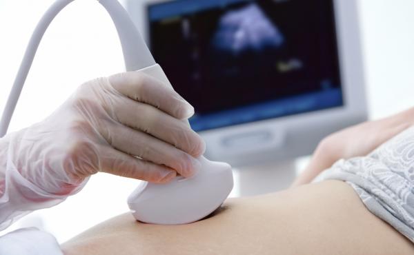 A woman gets a sonogram A woman gets a sonogram