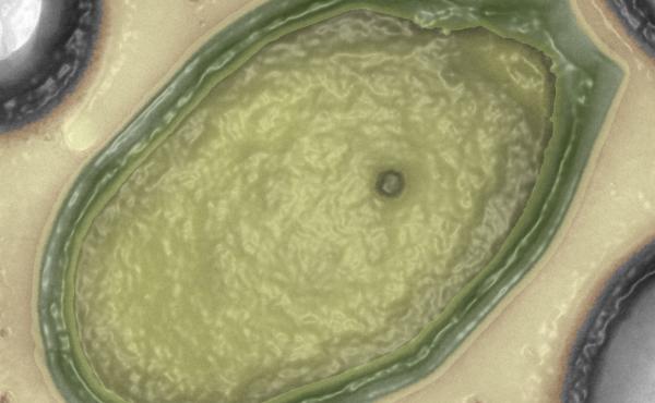 Pandoraviruses were discovered lurking in the mud of Chile and Australia, half a world apart. Pandoraviruses were discovered lurking in the mud of Chile and Australia, half a world apart.