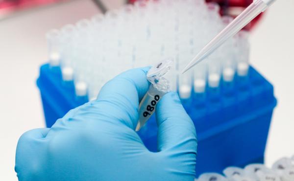 A medical researcher prepares tests for various diseases including Zika. A medical researcher prepares tests for various diseases including Zika.