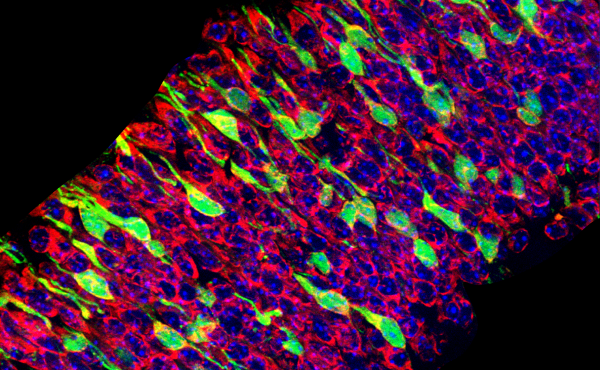 This image depicts a tissue section through a mouse embryonic brain in which migrating neurons are depicted in green. The remaining cells of the brain are composed of neurons and neural stem cells (red and blue). This image depicts a tissue section through a mouse embryonic brain in which migrating neurons are depicted in green. The remaining cells of the brain are composed of neurons and neural stem cells (red and blue).