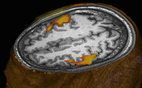 An MRI scan of a person listening to music shows brain areas that respond. (This scan wasn't part of the research comparing humans and monkeys.) An MRI scan of a person listening to music shows brain areas that respond. (This scan wasn't part of the research comparing humans and monkeys.)