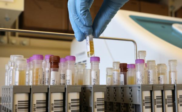 Researchers at the University of Washington Medicine Retrovirology Lab at Harborview Medical Center in Seattle process samples from Novavax's phase 3 COVID-19 vaccine clinical trial in February 2021. Researchers at the University of Washington Medicine Retrovirology Lab at Harborview Medical Center in Seattle process samples from Novavax's phase 3 COVID-19 vaccine clinical trial in February 2021.