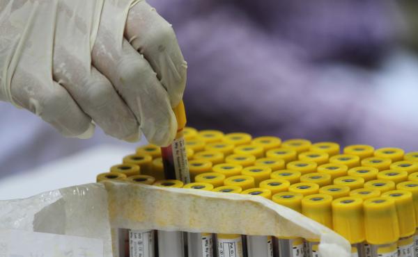 Testing your antibody levels to get a sense of your COVID-19 protection may be tempting, especially as you wait for a booster shot. But scientists say these widely available tests can't tell you the full story, at least not yet. Testing your antibody levels to get a sense of your COVID-19 protection may be tempting, especially as you wait for a booster shot. But scientists say these widely available tests can't tell you the full story, at least not yet.
