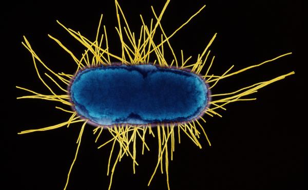 Colored transmission electron micrograph of a section through an Escherichia coli bacterium. This rod-shaped bacterium moves via its hair-like flagellae (yellow). Colored transmission electron micrograph of a section through an Escherichia coli bacterium. This rod-shaped bacterium moves via its hair-like flagellae (yellow).