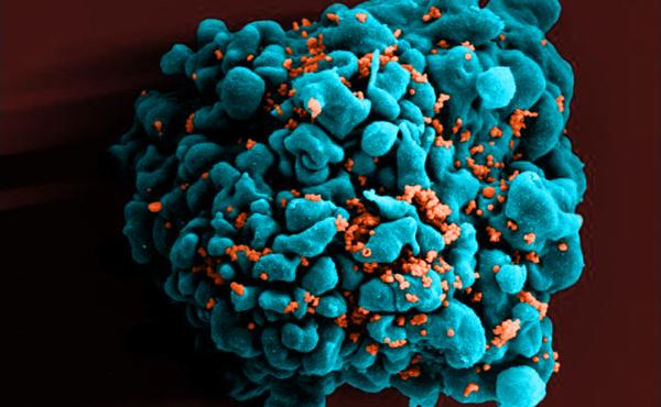 A color-enhanced scanning electron micrograph shows HIV particles (orange) infecting a T cell, one of the white blood cells that play a central role in the immune system. A color-enhanced scanning electron micrograph shows HIV particles (orange) infecting a T cell, one of the white blood cells that play a central role in the immune system.