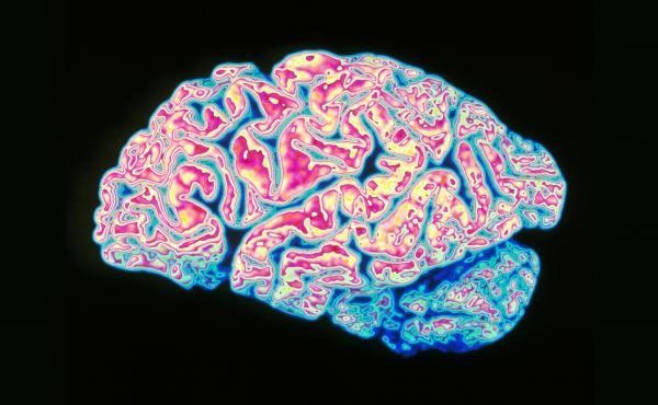 Alzheimer's disease causes atrophy of brain tissue. The discovery that lymph vessels near the brain's surface help remove waste suggests glitches in the lymph system might be involved in Alzheimer's and a variety of other brain diseases. Alzheimer's disease causes atrophy of brain tissue. The discovery that lymph vessels near the brain's surface help remove waste suggests glitches in the lymph system might be involved in Alzheimer's and a variety of other brain diseases.