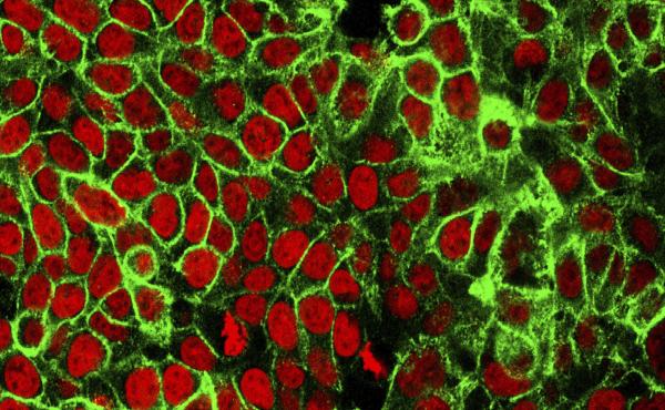 This microscope image from the National Cancer Institute Center for Cancer Research shows human colon cancer cells with the nuclei stained red. Americans should start getting screened for colon cancer at age 45, according to new guidelines from the U.S. P This microscope image from the National Cancer Institute Center for Cancer Research shows human colon cancer cells with the nuclei stained red. Americans should start getting screened for colon cancer at age 45, according to new guidelines from the U.S. P