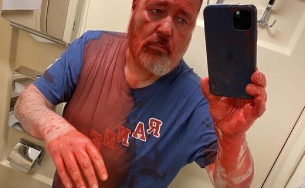 Russian journalist Dmitry Muratov, covered in red paint, takes a picture following the attack on him while on board a train from Moscow to Samara. Russian journalist Dmitry Muratov, covered in red paint, takes a picture following the attack on him while on board a train from Moscow to Samara.